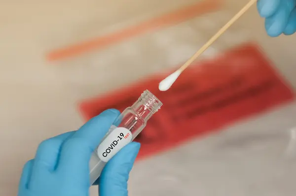 "All analysis of COVID-19 pre-departure test results to date have been negative, obviously," the statement from the Health Ministry said.