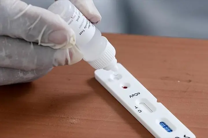 A total of more than 28,000 tests had been conducted since the beginning of our response.