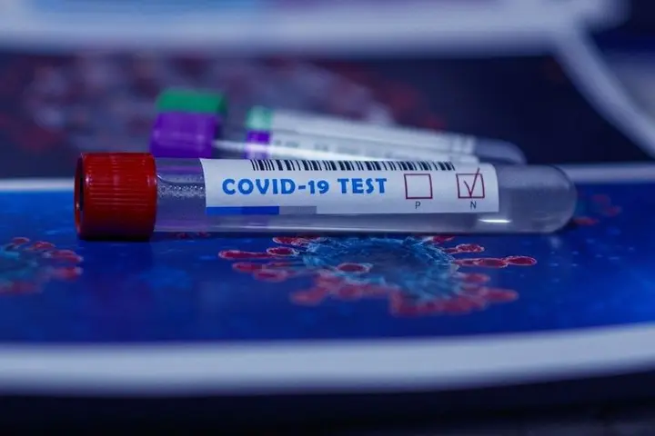 “Our fourth case was retested and is now negative. Therefore, all our four initial positive cases are now negative,” he said.