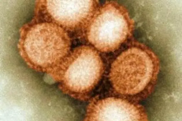 According to the WHO, there have been at least 29,669 cases of the swine (H1N1) flu, including 145 deaths.