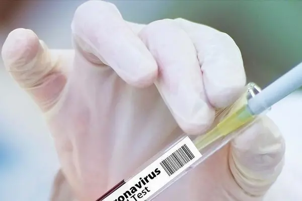 "As per the Quarantine protocols, no item can be sent outside from quarantine station without prior approval from the relevant authorities,” the statement from the Ministry of Health reads.