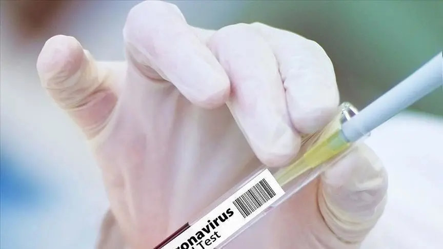 "As per the Quarantine protocols, no item can be sent outside from quarantine station without prior approval from the relevant authorities,” the statement from the Ministry of Health reads.