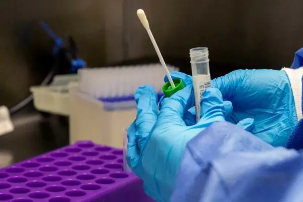 The Center for Disease Control and Prevention (CDC) says common human coronaviruses, including types 229E, NL63, OC43, and HKU1, usually cause mild to moderate upper-respiratory tract illnesses, like the common cold.