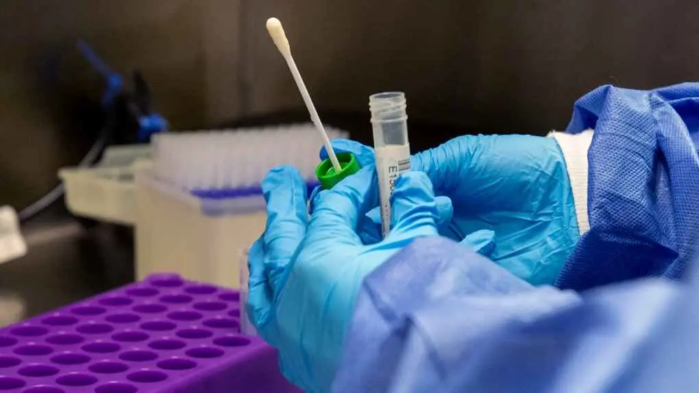 The Center for Disease Control and Prevention (CDC) says common human coronaviruses, including types 229E, NL63, OC43, and HKU1, usually cause mild to moderate upper-respiratory tract illnesses, like the common cold.