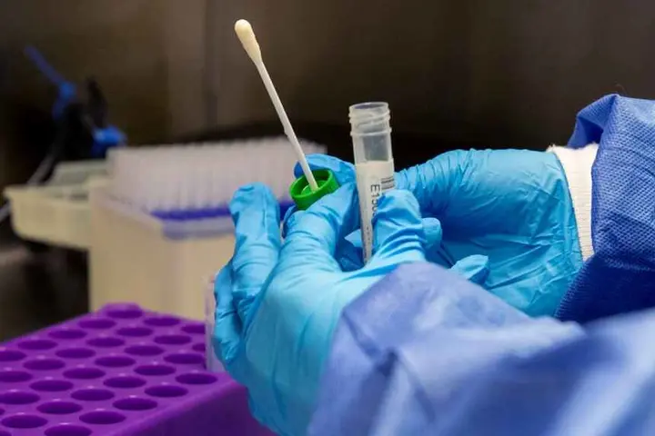 The Center for Disease Control and Prevention (CDC) says common human coronaviruses, including types 229E, NL63, OC43, and HKU1, usually cause mild to moderate upper-respiratory tract illnesses, like the common cold.
