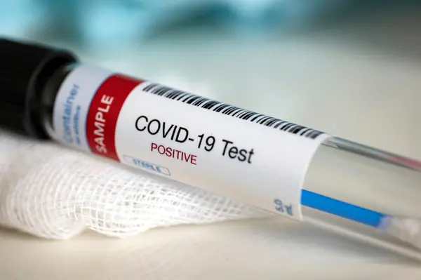 He says the latest development means the total cases of positive COVID-19 recorded in the Solomon Islands is now 18.