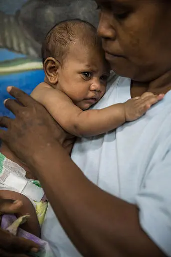 Elsie holding her 4 months-old daughter Elmah who has had diarrhoea for several days and waits to be attended by Doctors at Honiara Central Referral Hospital.