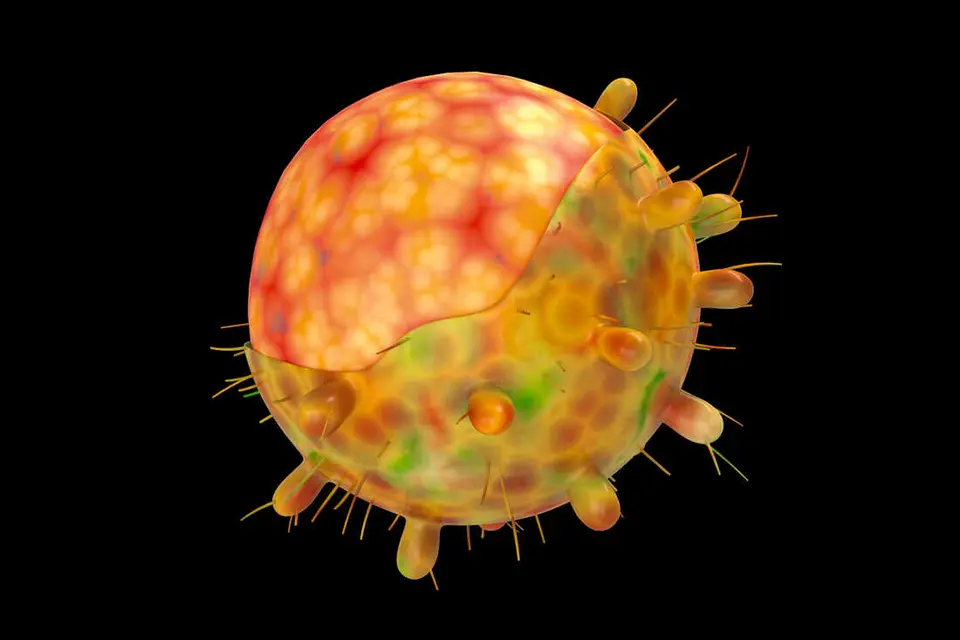 He says samples have been sent to Australia for genome sequencing to determine the variant, with all likelihood pointing to the highly contagious Omicron variant.