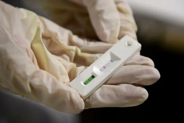 He says as a result tests will be delayed as the lab is currently operating under a skeleton staff and is increasingly relying on rapid antigen tests.