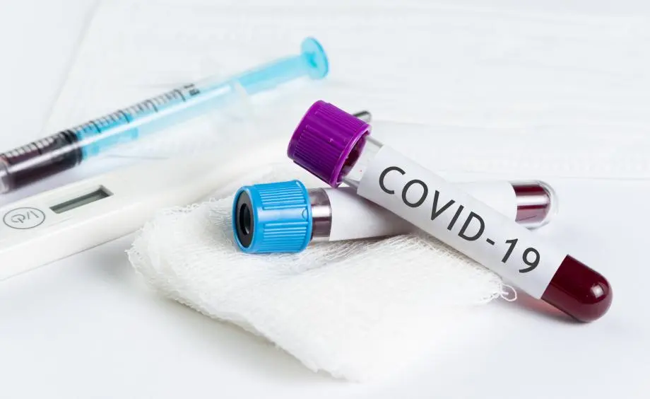 “We need to fight this as a country and not as a Government, civil society, or as a private sector. We all have a role to play in conquering the corona pandemic,” he said.