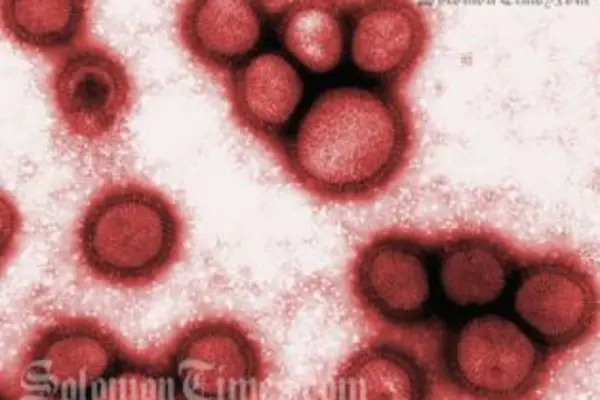 The latest swine flu case is being quarantined at RAMSI's Aspen Medical Centre.