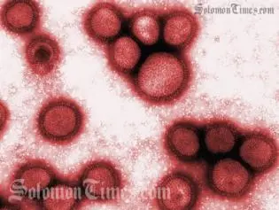 The latest swine flu case is being quarantined at RAMSI's Aspen Medical Centre.