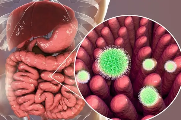 Rotavirus is the most common cause of diarrhea disease among infants and young children.