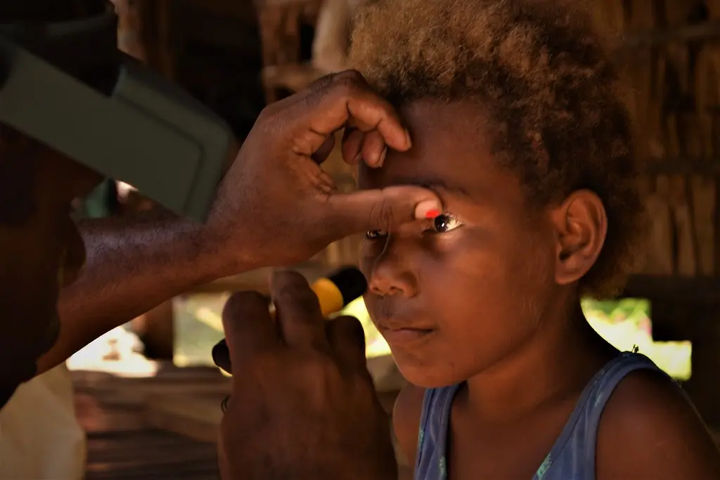 A trachoma grader examine the eyes of a young girl in Solomon Islands.