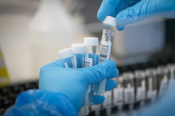 He says that his Ministry will confirm the number of confirmed cases since some people have had to be tested on both the rapid test and the PCR, which may raise the registered positive cases artificially.