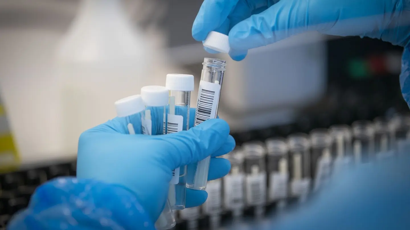 He says that his Ministry will confirm the number of confirmed cases since some people have had to be tested on both the rapid test and the PCR, which may raise the registered positive cases artificially.