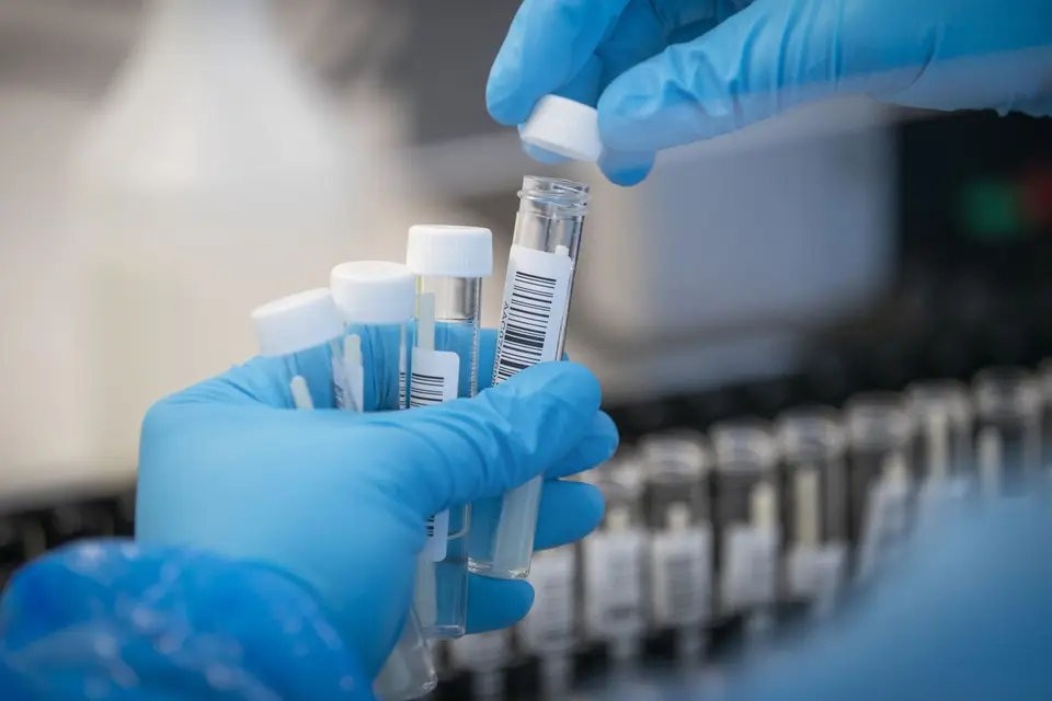 He says that his Ministry will confirm the number of confirmed cases since some people have had to be tested on both the rapid test and the PCR, which may raise the registered positive cases artificially.