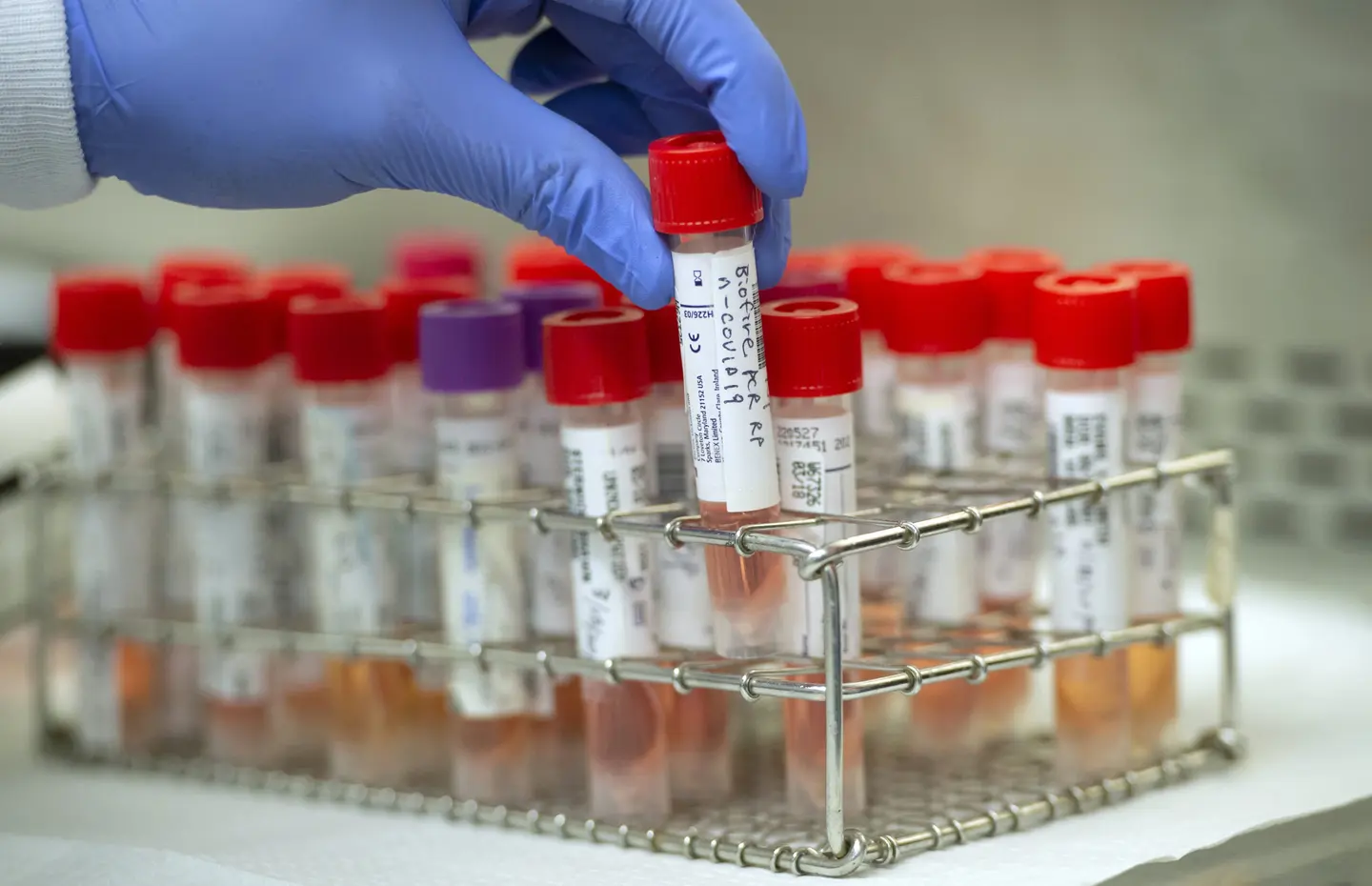 He adds, a total of 28,000 tests have been conducted since the beginning of the country’s response to the global pandemic.