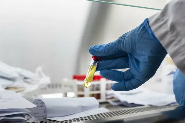 The Ministry says that any persons with flu-like illness need to get tested at the nearest health clinic. Should tests return positive they are to self-isolate at home for at least 7 days.