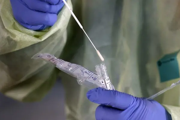 They say if patients are not showing signs and symptoms of being sick, such as runny nose, coughing, fever and shortness of breath they will not be swabbed for tests.