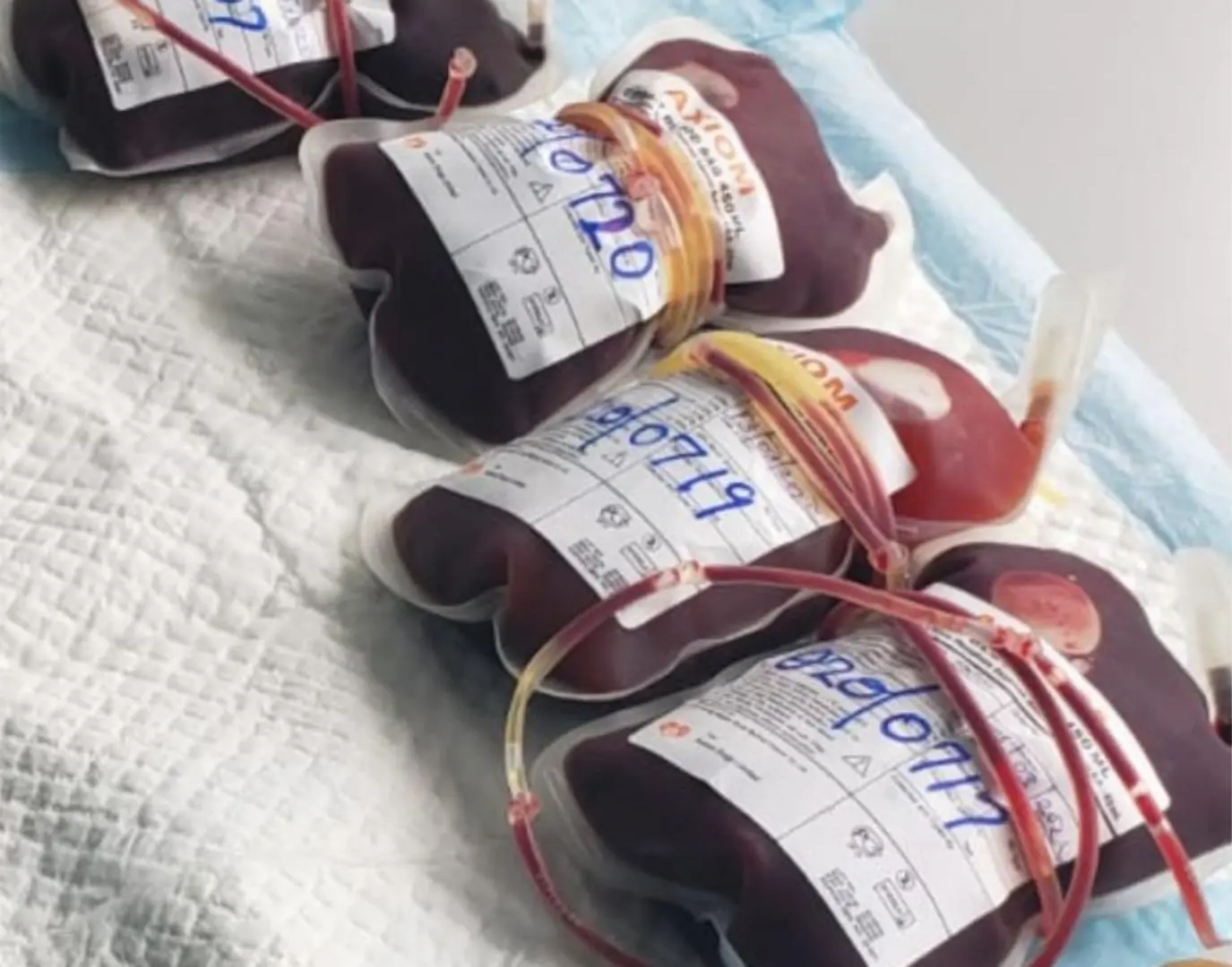 The Solomon Islands Red Cross Society is the only organization that has a blood donor voluntary program. Civic awareness on the importance of blood donation is an on-going activity for the Society. However, the fear of needles and sight of blood is an enduring challenge for them.