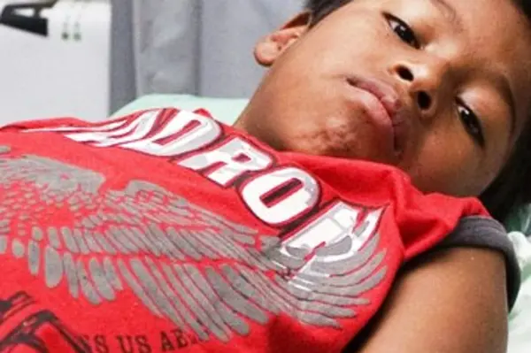 Honiara has so far recorded the highest prevalence of dengue fever with 89 per cent of reported cases.