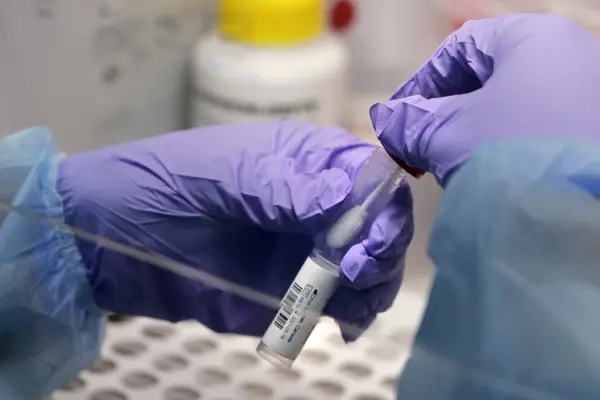 Of the 10 deaths, 4 had influenza A H3, 1 with chlamydia pneumonia, 2 had no swabs taken, 1 swab was invalid and 1 swab returned negative for any viruses or bacteria and the other result is still pending.