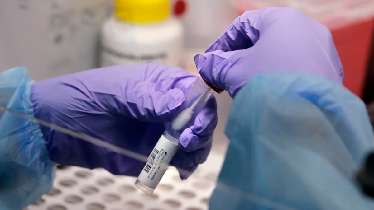 Of the 10 deaths, 4 had influenza A H3, 1 with chlamydia pneumonia, 2 had no swabs taken, 1 swab was invalid and 1 swab returned negative for any viruses or bacteria and the other result is still pending.