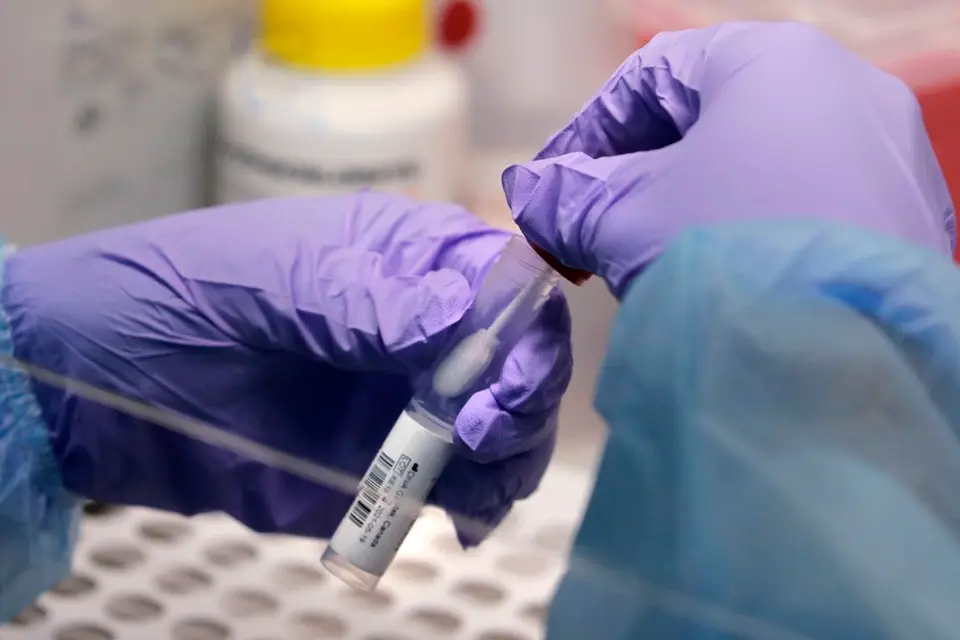 Of the 10 deaths, 4 had influenza A H3, 1 with chlamydia pneumonia, 2 had no swabs taken, 1 swab was invalid and 1 swab returned negative for any viruses or bacteria and the other result is still pending.