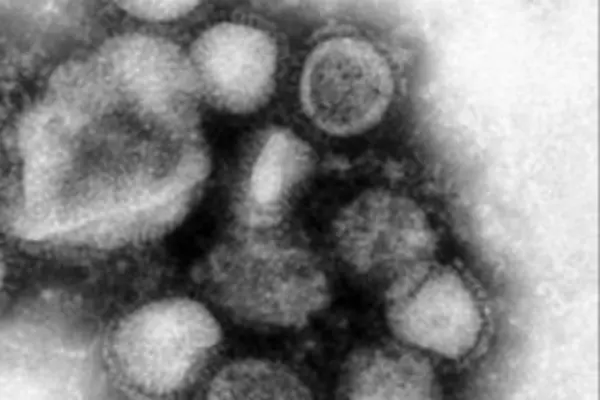 Dr Alependava says one of the five people "had displayed symptoms of influenza A or swine flu but is yet to be confirmed."