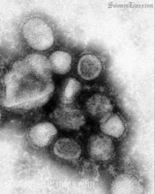 Dr Alependava says one of the five people "had displayed symptoms of influenza A or swine flu but is yet to be confirmed."