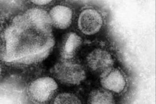 Dr Alependava says one of the five people "had displayed symptoms of influenza A or swine flu but is yet to be confirmed."